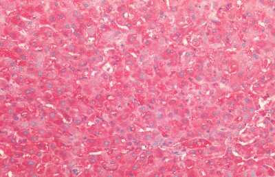 Immunohistochemistry: HSP60 Antibody [NBP2-12734]